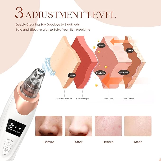 Vacuum Blackhead Remover Face Black Spots, White Dot, Pimple Removal