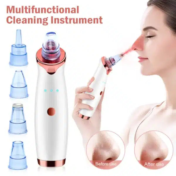 Vacuum Blackhead Remover Face Black Spots, White Dot, Pimple Removal