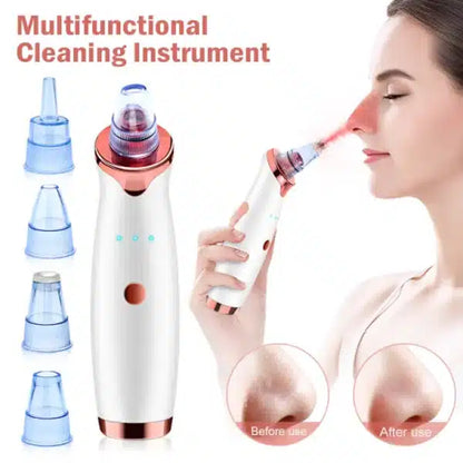Vacuum Blackhead Remover Face Black Spots, White Dot, Pimple Removal